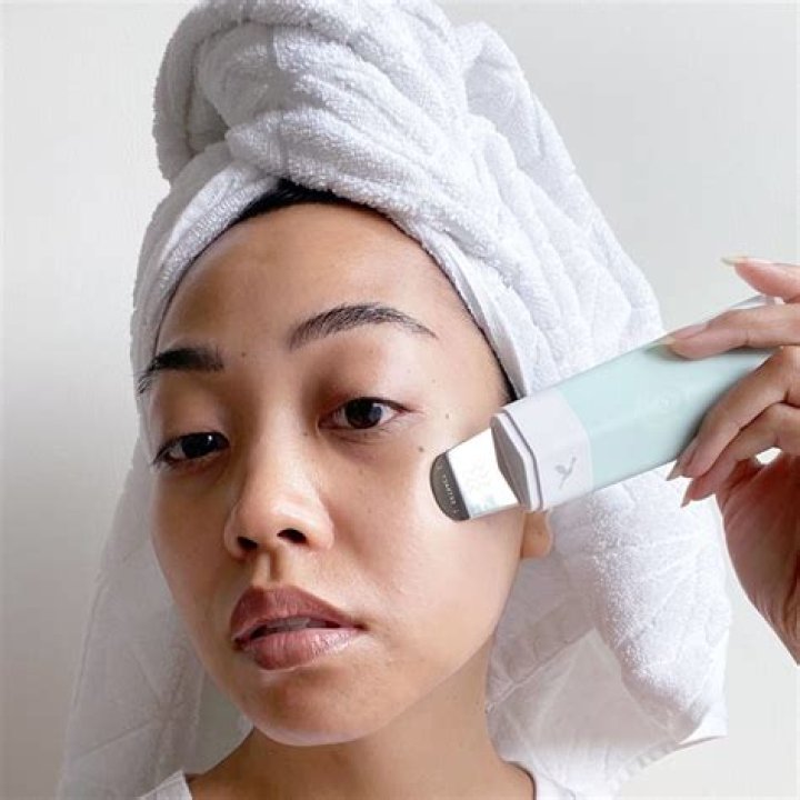dermaflash review