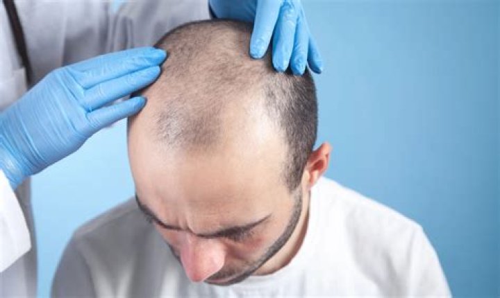 Does Hair Training Work? We Asked the Experts