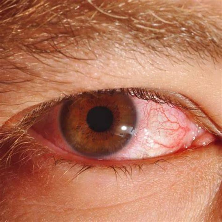 Eye Scroll and Eye Pause