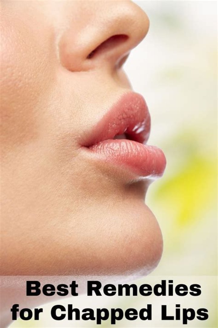 How to Fix Severe Chapped Lips Overnight